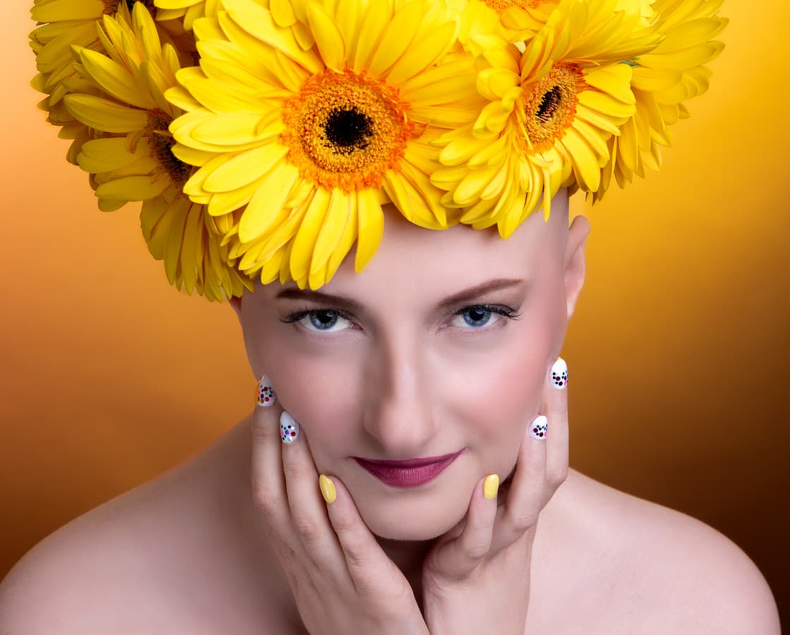 g3 osteosarcoma survivor
