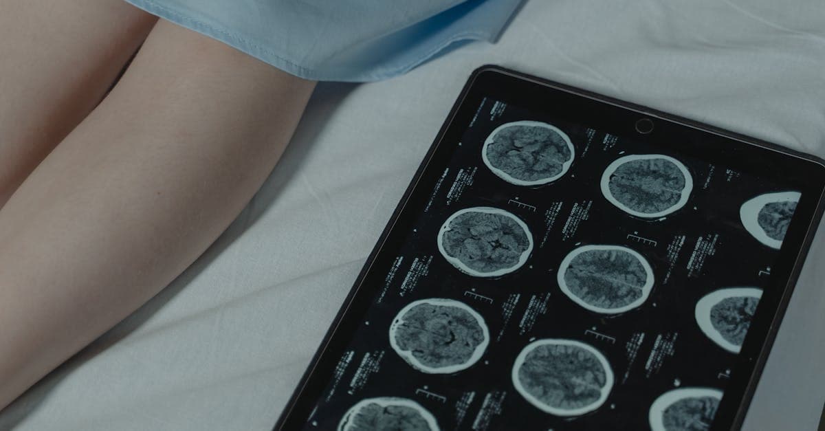 Begrijpen van cytogenetische tests voor kanker: Diagnose, behandeling en doorbraken