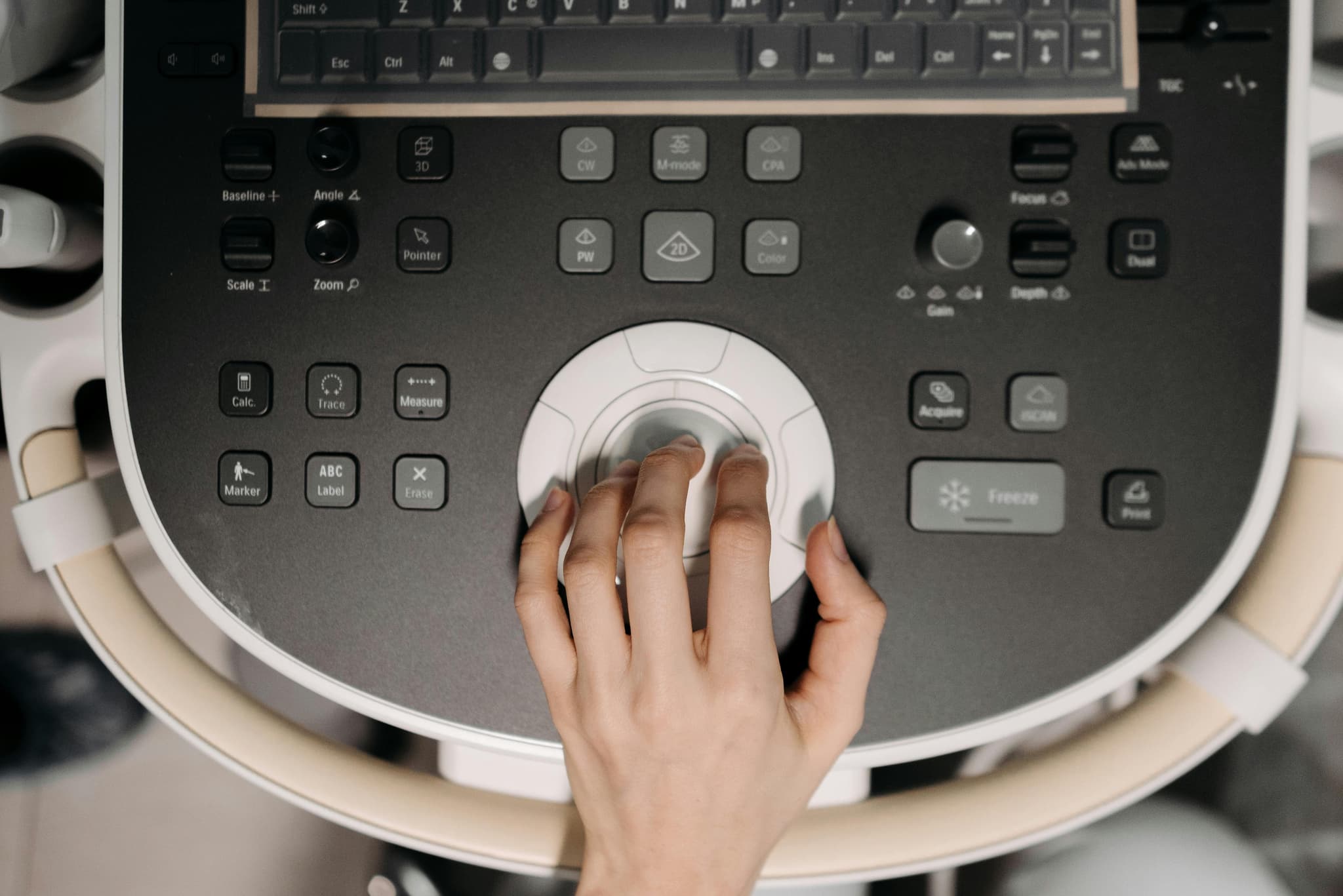 How Often Should You Get a Colonoscopy? A Complete Guide to Screening Frequency