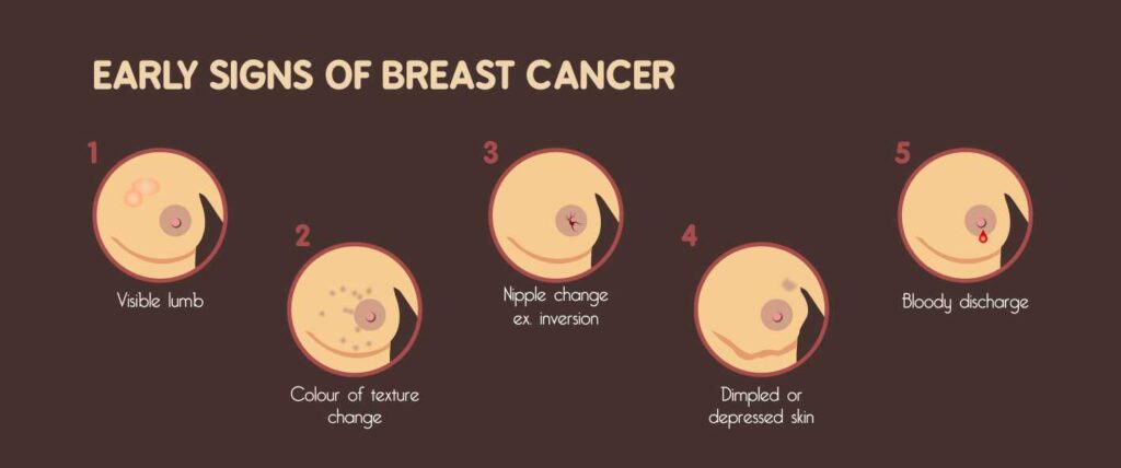 No babies, no boobs, no nipples: Coping with breast cancer under