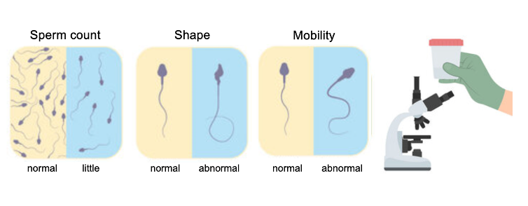 Semen Analysis visualized, how does semen analysis work